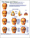Nose and Sinuses