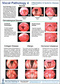Vocal Pathology IV