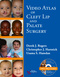 Video Atlas of Cleft Lip and Palate Surgery