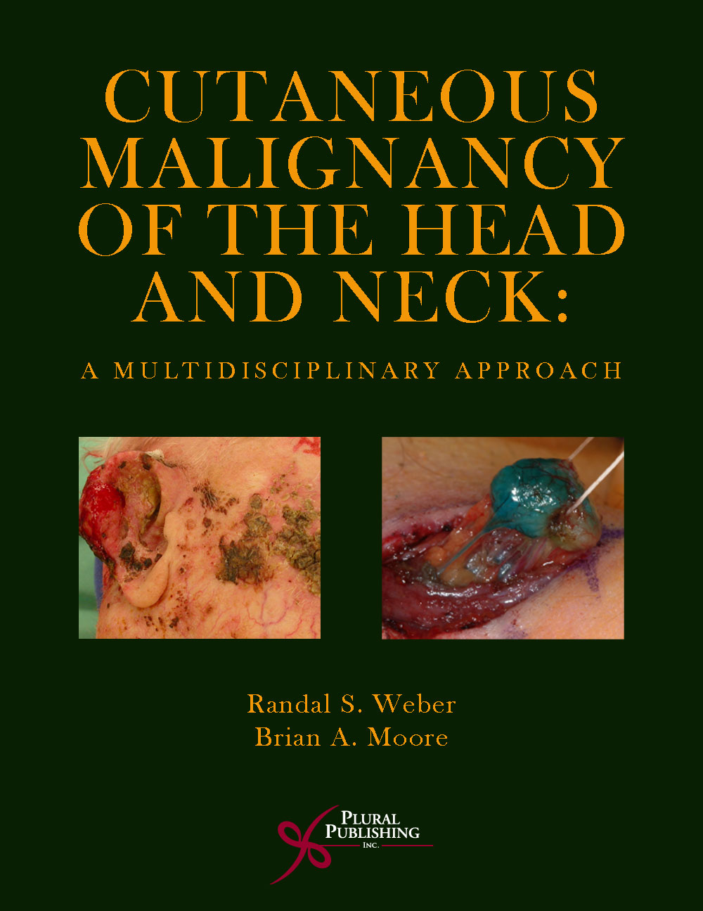 Cutaneous Malignancy of the Head and Neck: A Multidisciplinary Approach