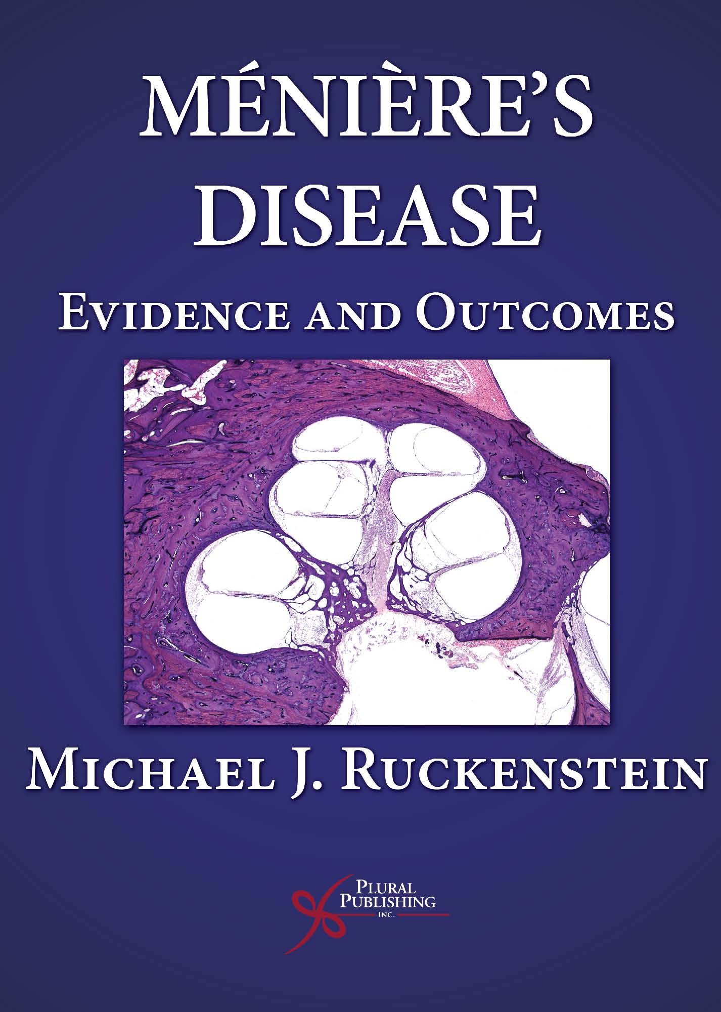Ménière's Disease: Evidence and Outcomes