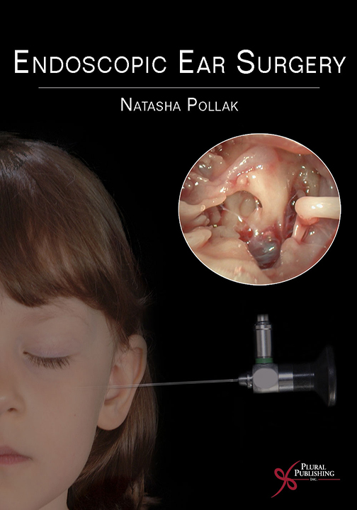 Stapedectomy Surgery for Otosclerosis - Ear Doctor Los Angeles, CA