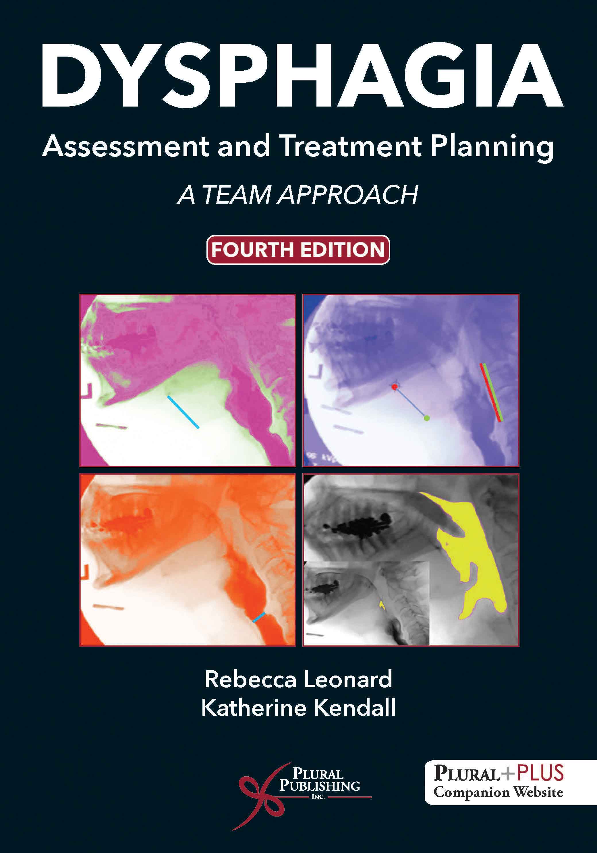Dysphagia Assessment and Treatment Planning: A Team Approach.
