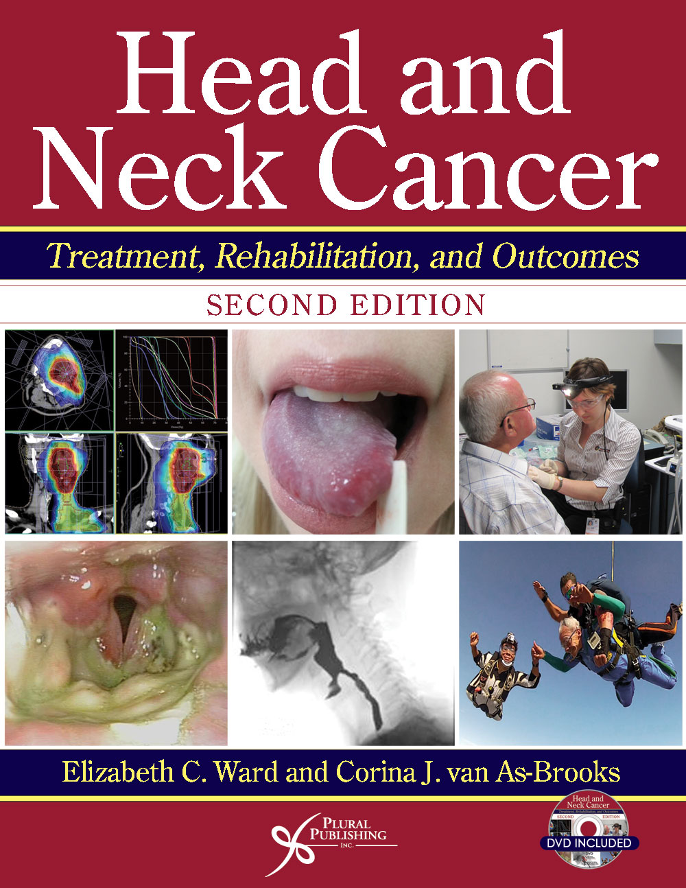 Head and Neck Cancer: Treatment, Rehabilitation, and Outcomes.