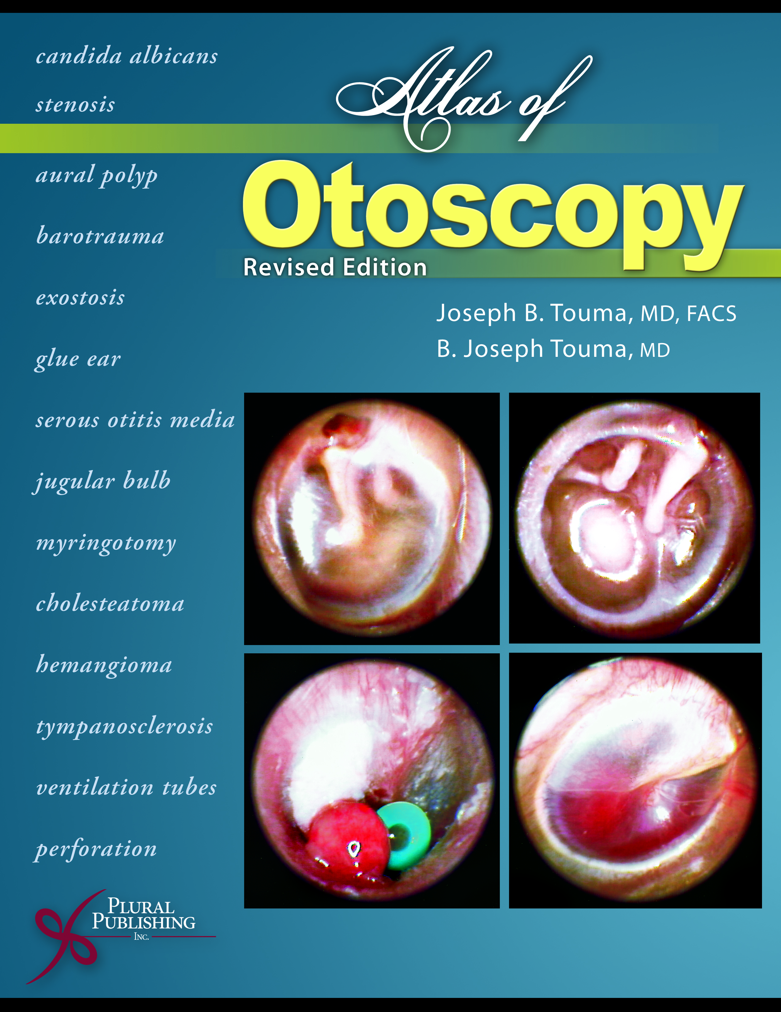 Atlas of Otoscopy.