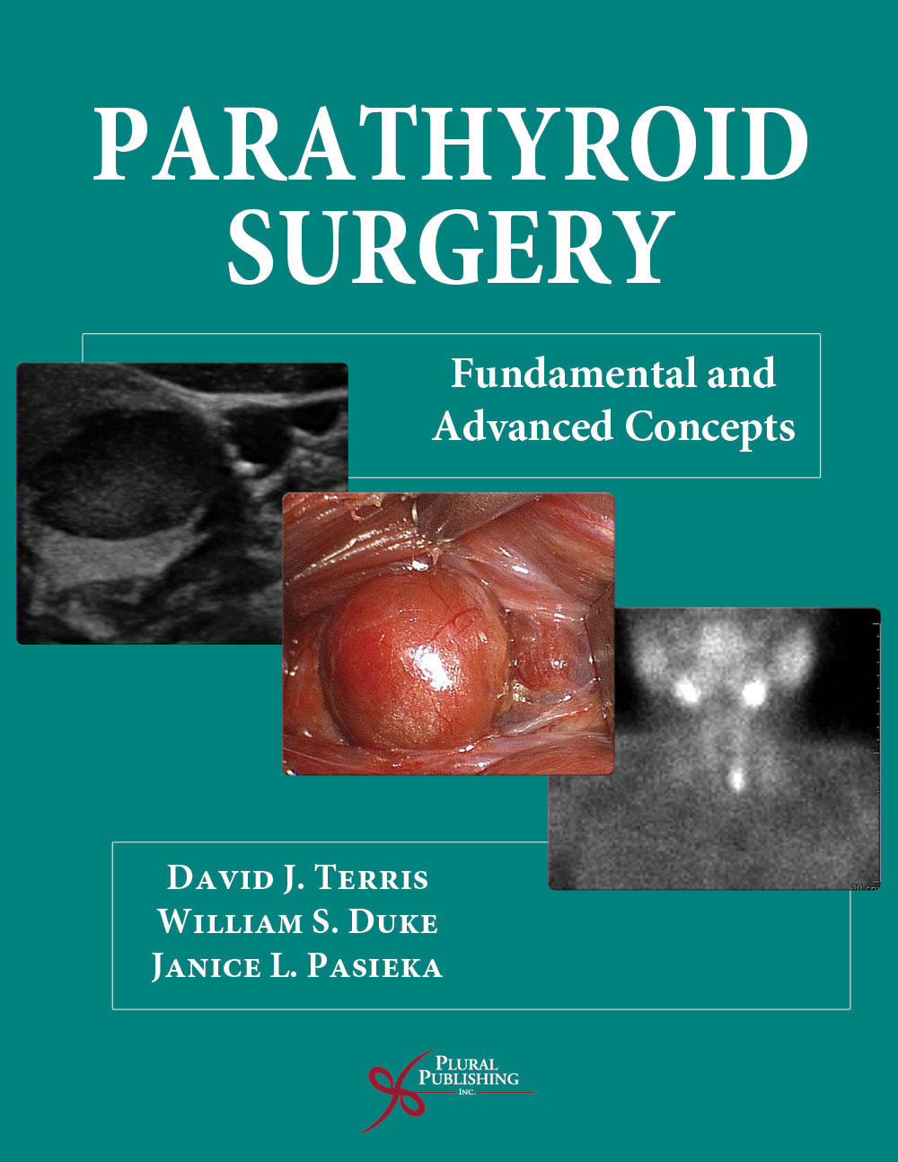 Parathyroid Surgery: Fundamental and Advanced Concepts