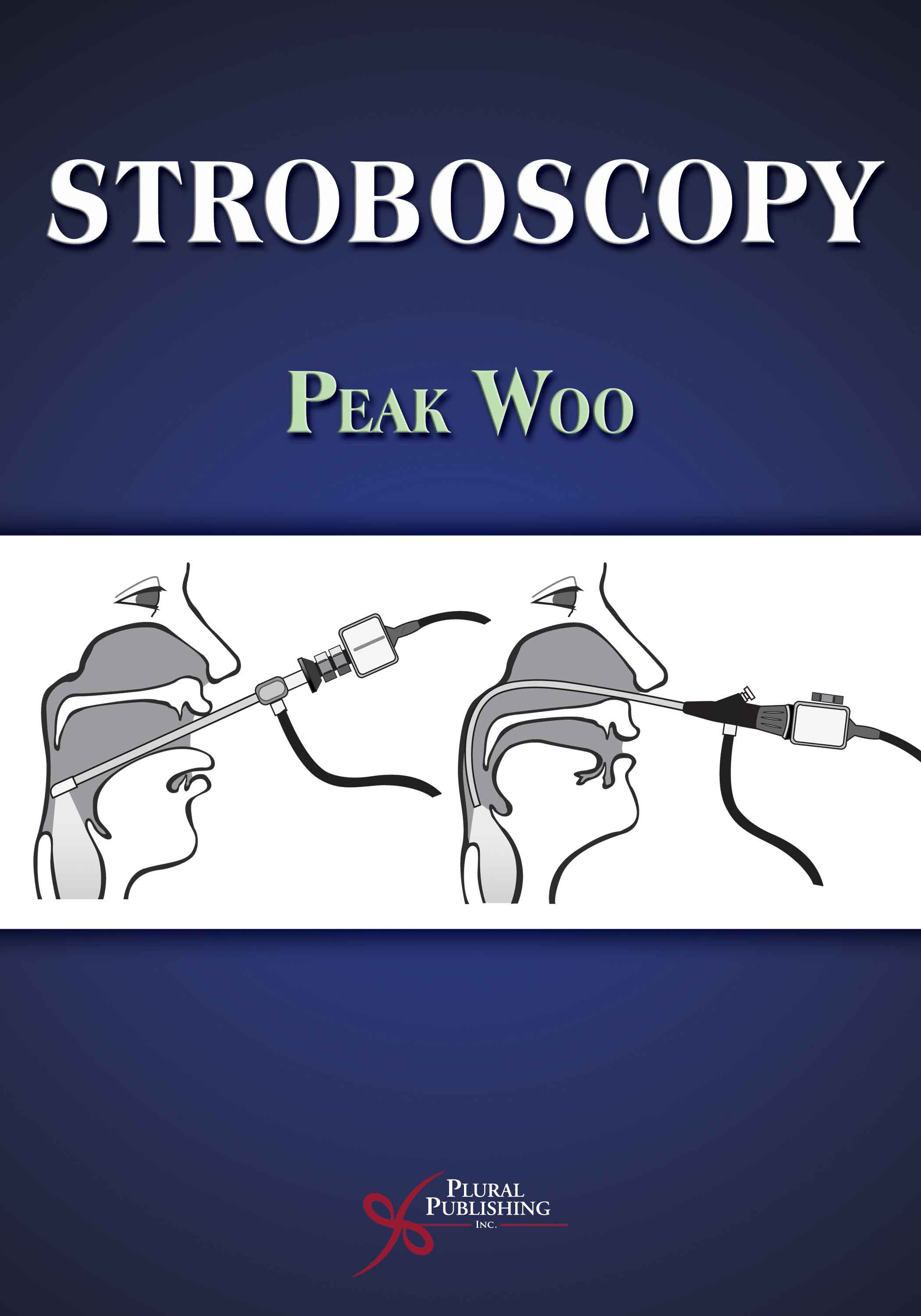Stroboscopy