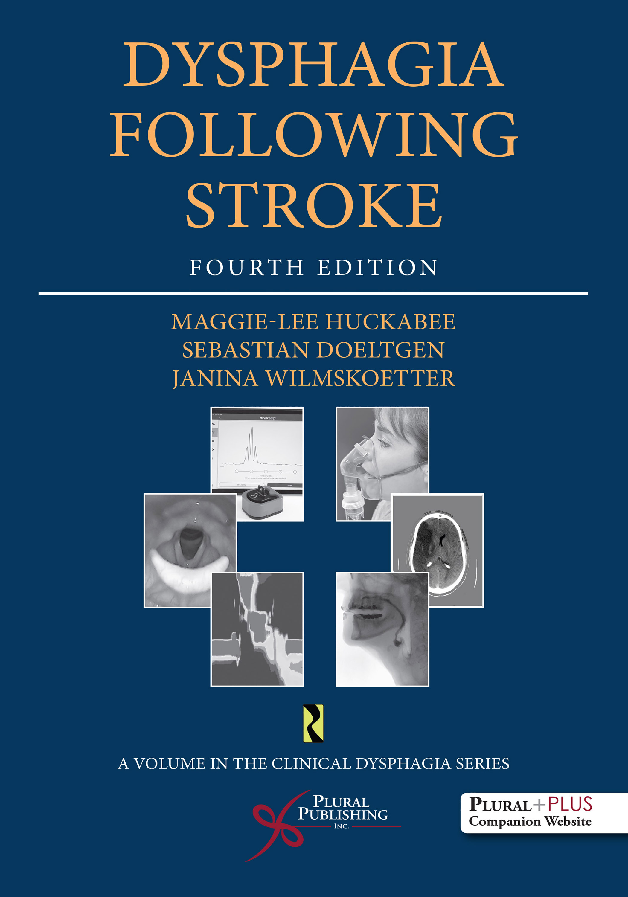 Dysphagia Following Stroke Cover
